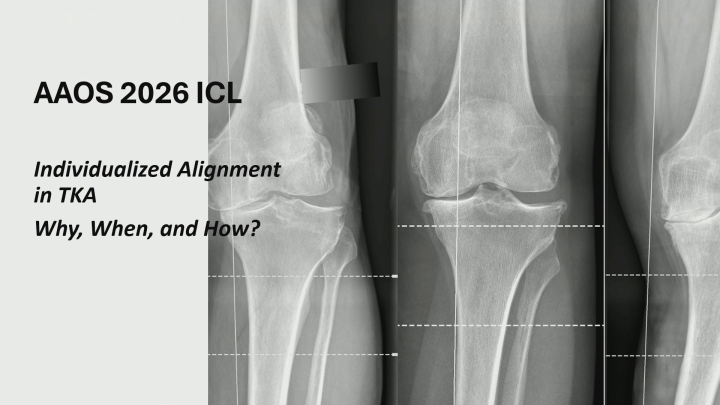 Alignment Strategies in Total Knee Arthroplasty: The Why, When, and How ...