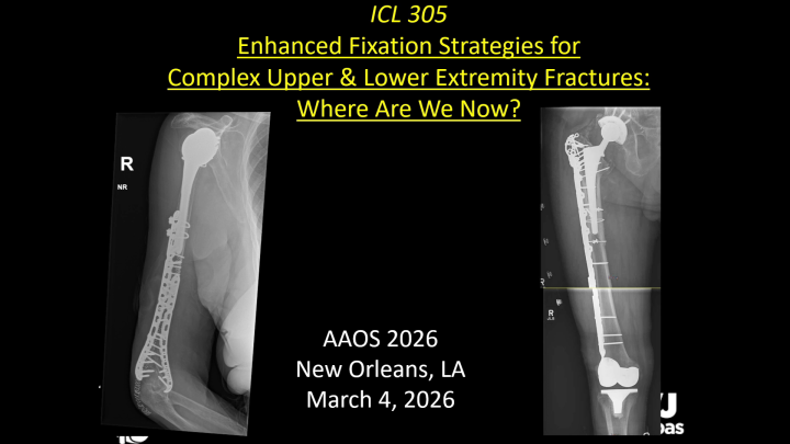 Enhanced Fixation Strategies for Complex Upper and Lower Extremity ...
