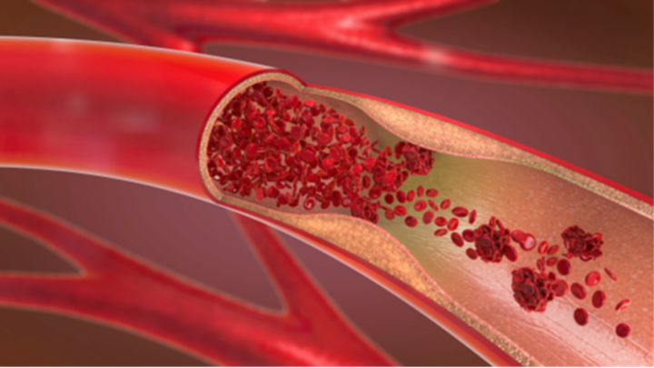 Heart-Brain and Vascular Health - AHA OnDemand