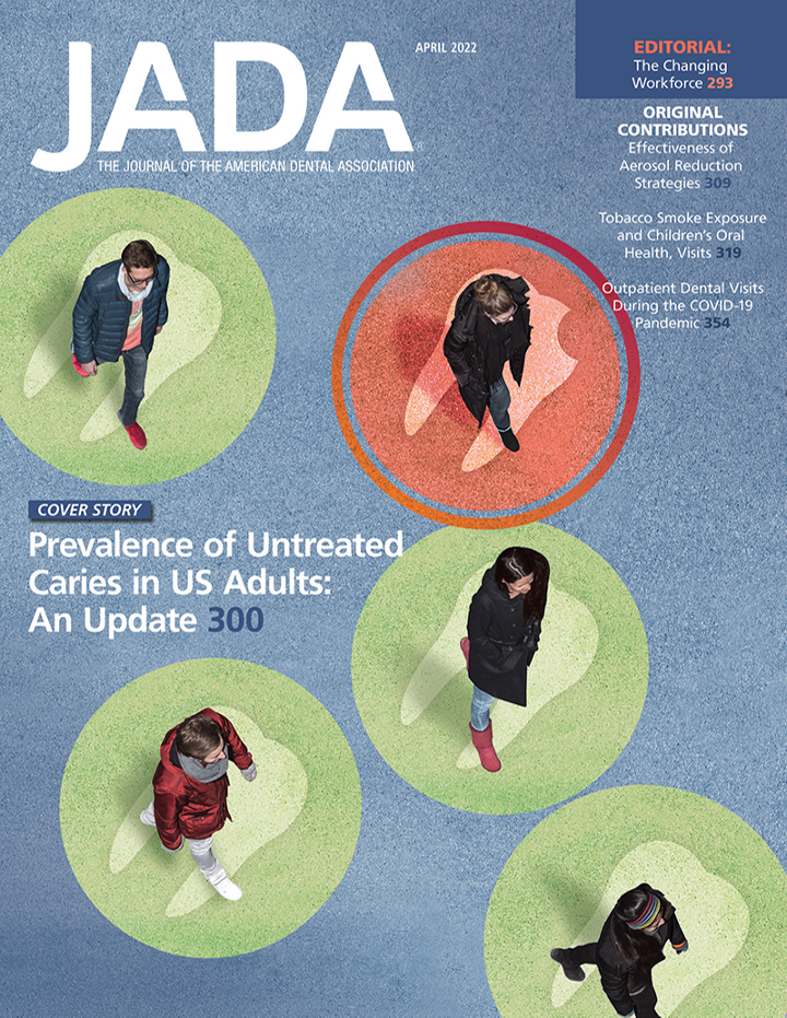Update on the prevalence of untreated caries in the US adult population, 20172020 (April 2022