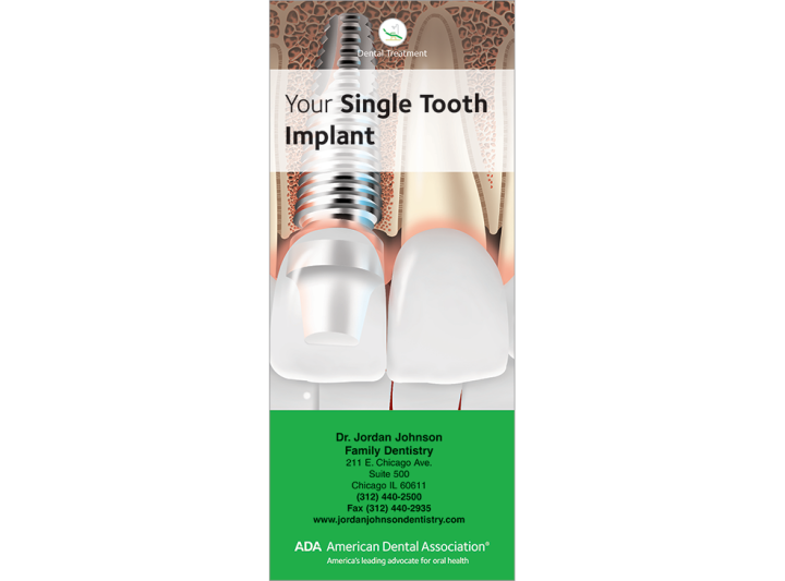 PERSONALIZED Your Single Tooth Implant - American Dental Association