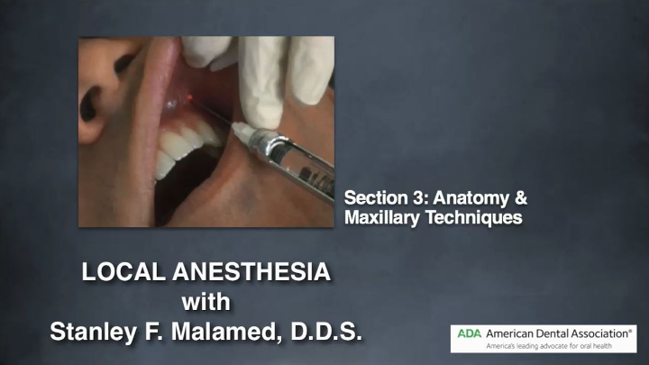 Mastering Anesthesia Techniques: Ensuring Comfort and Safety
