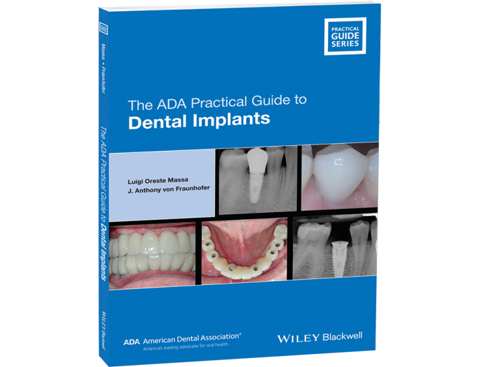 The ADA Practical Guide to Dental Implants American Dental Association