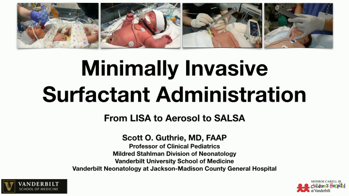Minimally Invasive Surfactant Administration: From LISA to Aerosol to ...