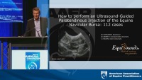 How to Perform an Ultrasound-Guided Paratendinous Injection of the ...