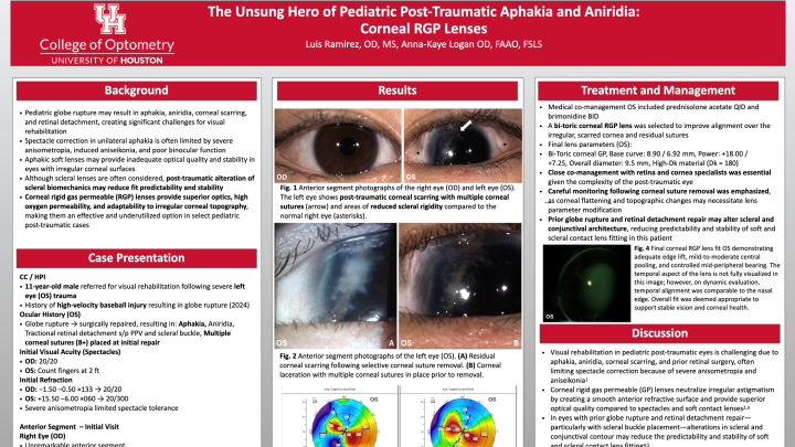 The Unsung Hero of Pediatric Post-Traumatic Aphakia and Aniridia ...