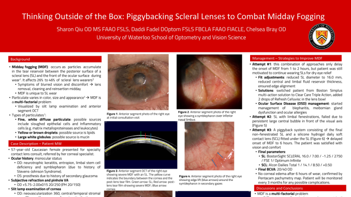 54B: Thinking Outside of the Box: Piggybacking Scleral Lenses to Combat ...