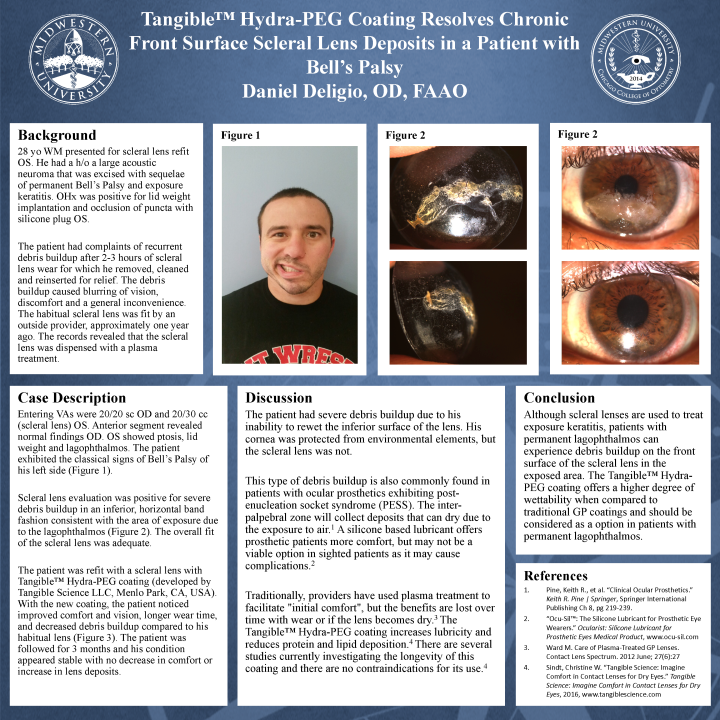 71 - Tangible Hydra-PEG Coating Resolves Chronic Front Surface Scleral ...
