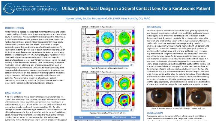 94 - Utilizing Multifocal Design in a Scleral Contact Lens for a ...