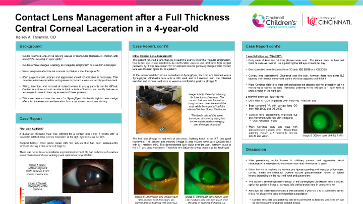14 - Contact Lens Management after a Full Thickness Central Corneal ...