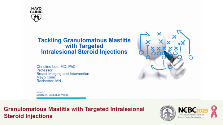 Granulomatous Mastitis with Targeted Intralesional Steroid Injections ...