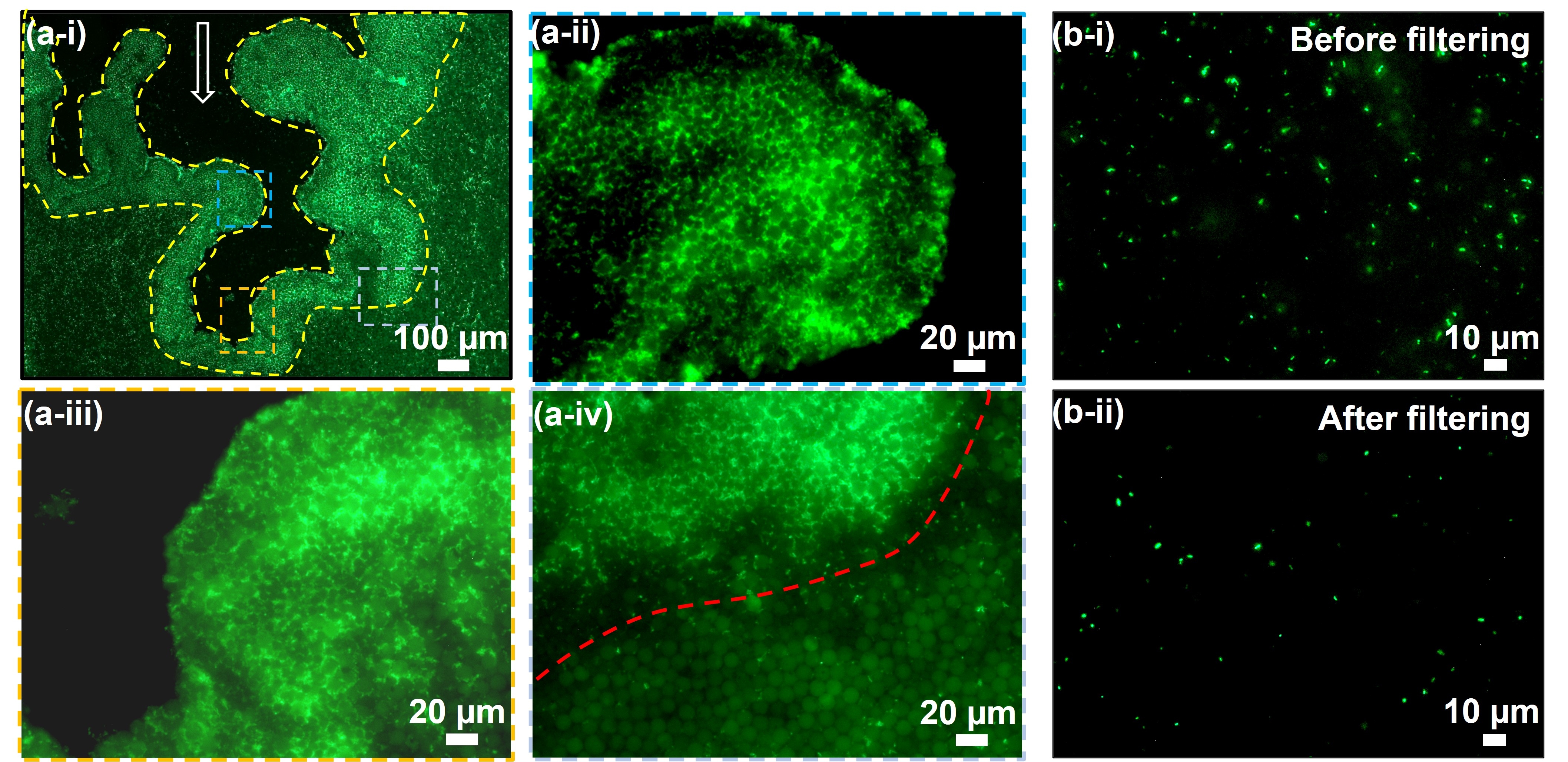Trapped Germs Rapid bacteria extraction from whole blood using a pneumatic regulated ...