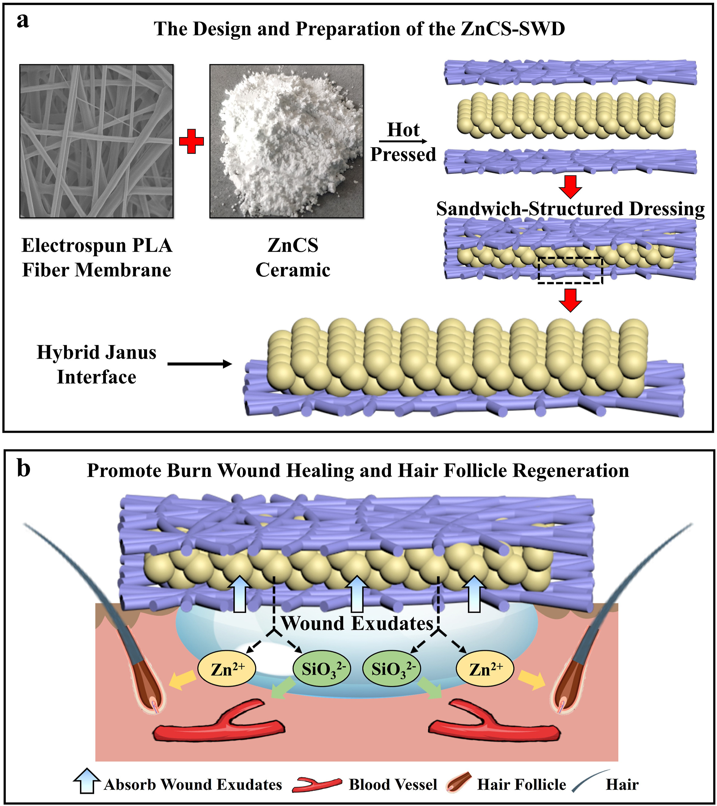 Design of a biofluid-absorbing bioactive sandwich-structured Zn–Si ...