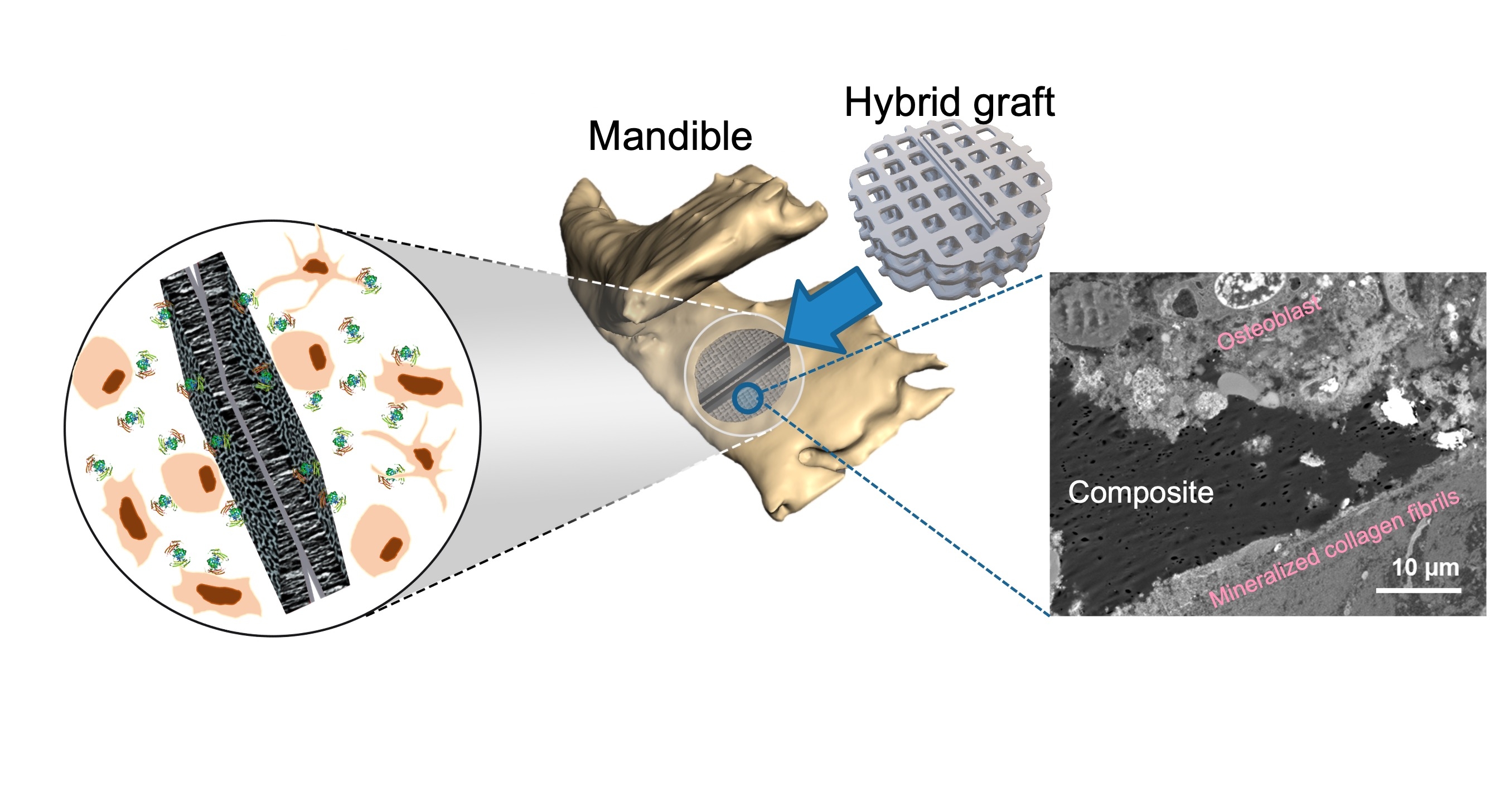 3D-printed bioactive scaffolds for bone regeneration - American ...